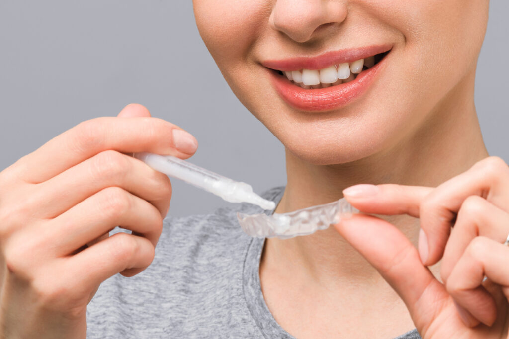 Teeth Whitening in High Point, NC